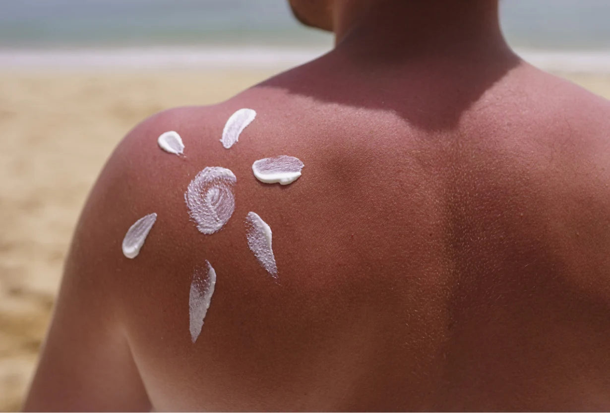 How To Treat Sun-Damaged Skin Back to Health
