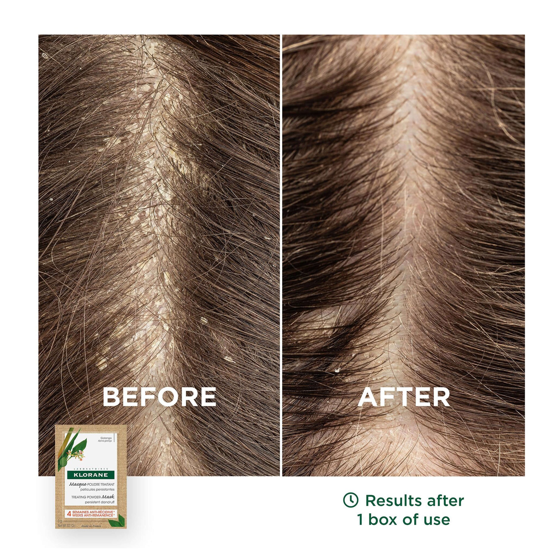 Klorane Galangal Anti-Dandruff Mask-Powder Treatment for Persistent Dandruff 8 x 3g